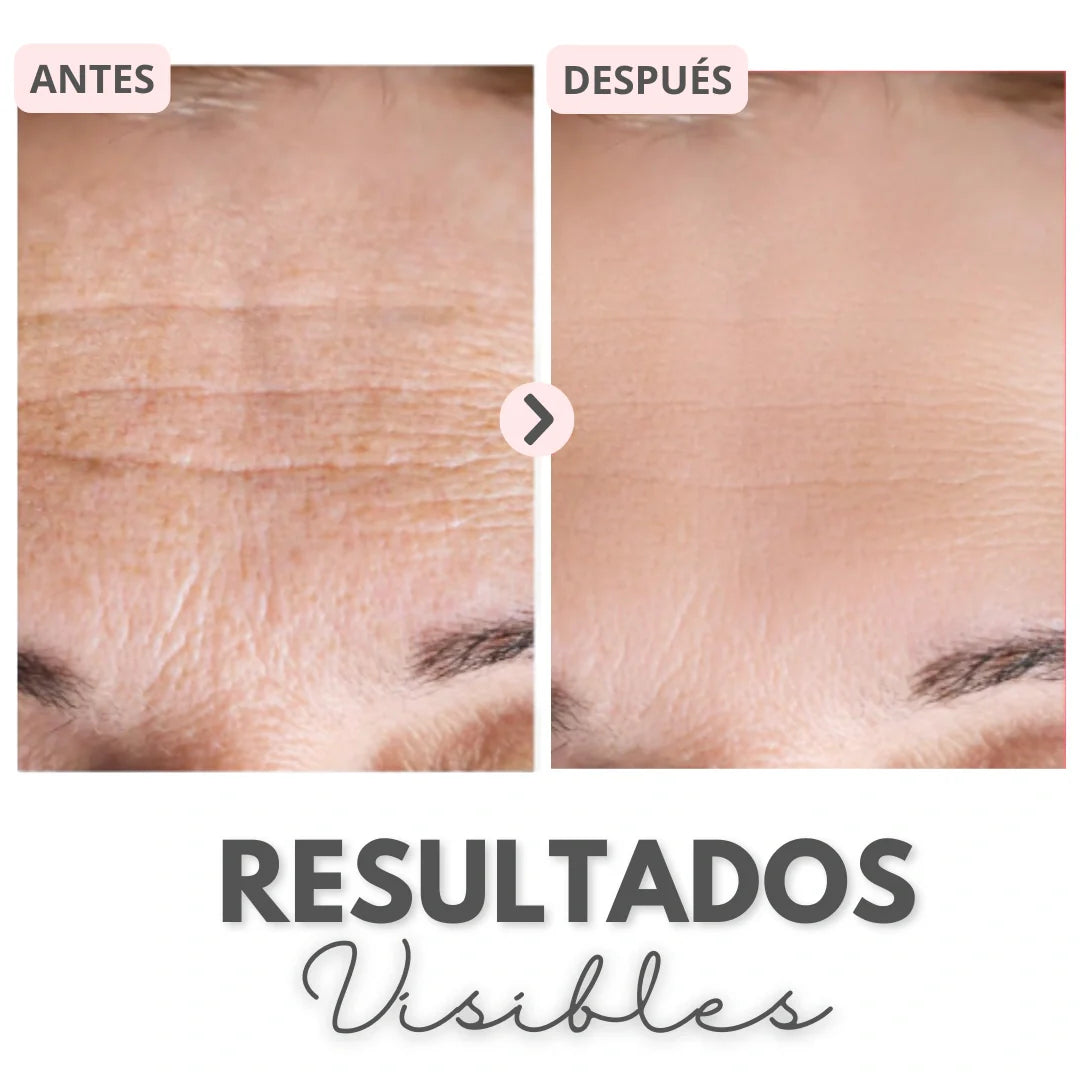 Luzderma® / Mascarilla de colágeno real