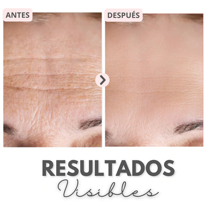 Luzderma® / Mascarilla de colágeno real